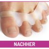 fu-gut-sv128-zehen-distanz-schiene-weiche-silikon-zehentrenner image 6