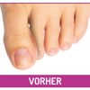 fu-gut-sv128-zehen-distanz-schiene-weiche-silikon-zehentrenner image 5