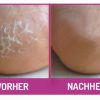 fu-gut-432-hornhaut-reduzier-balsam-f-r-fu-hand image 6